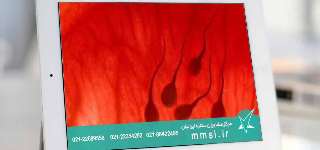 خون بعد از نزديكي در مردان1